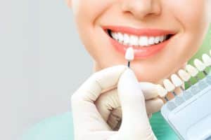 dental-veneer-treatment